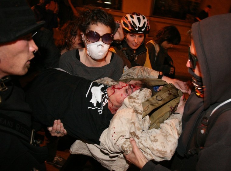 Image: Scott Olsen injured by a tear gas canister